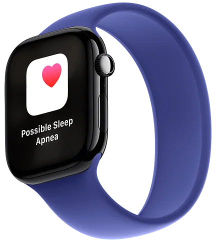 Apple Watch Series 10