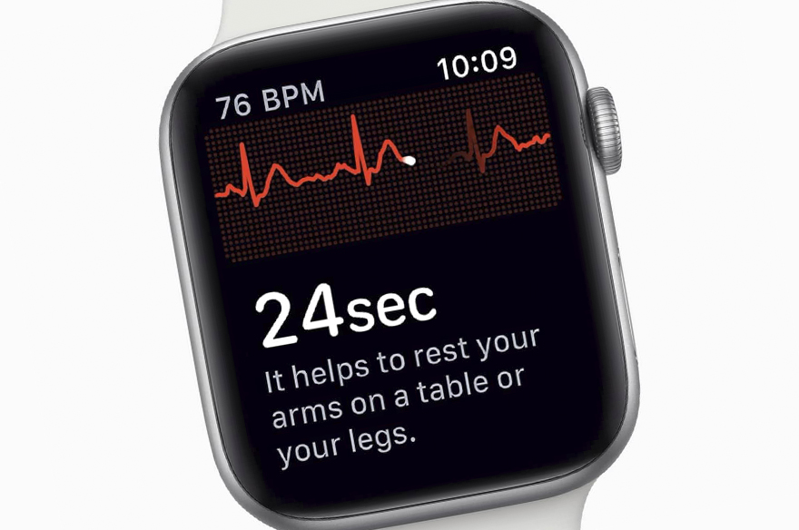 На Apple Watch заработала электрокардиограмма